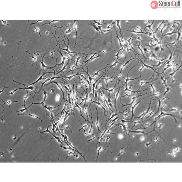 Mouse Neurons-striatal (MN-s) - Phase contrast, 100x.
