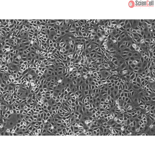 Mouse Pulmonary Alveolar Epithelial Cells (MPAEpiC) - Phase contrast, 100x

