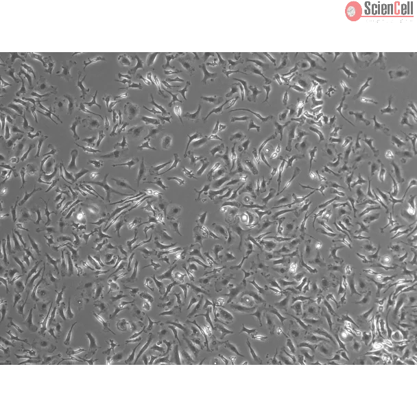 Mouse Pulmonary Alveolar Macrophages (MPAMa) - Phase contrast, 100x
