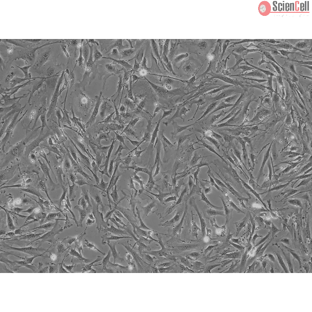 Mouse Pulmonary Fibroblasts (MPF) - Phase contrast, 100x.
