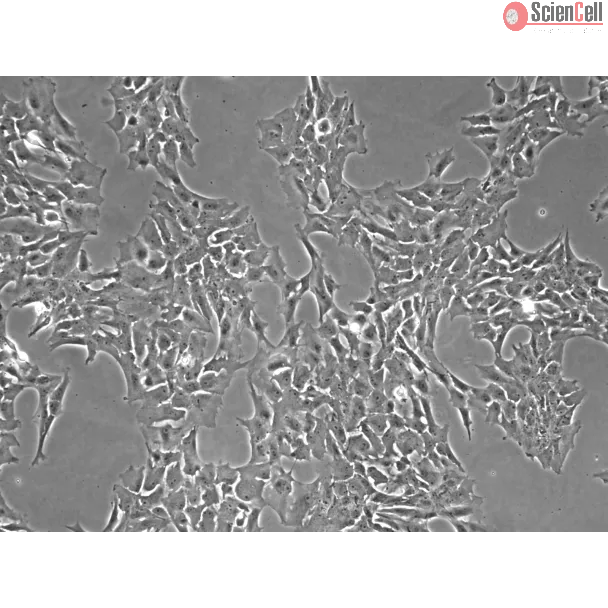 Porcine Retinal Astrocytes (PA-r)- Phase Contrast, 100x.
