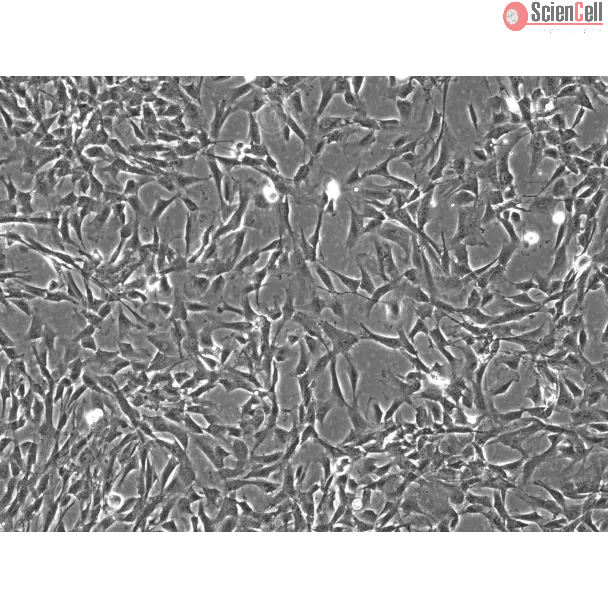 Rabbit Astrocytes (RabA) – Phase Contrast, 100X.
