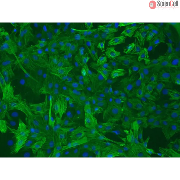 Rat Aortic Smooth Muscle Cells (RASMC) – Immunostaining for α-sma, 200x
