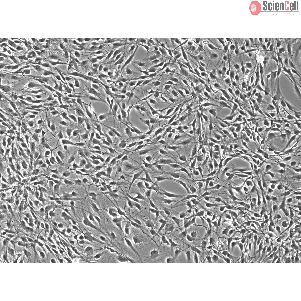 Rat Astrocytes-adult – Phase Contrast, 100x
