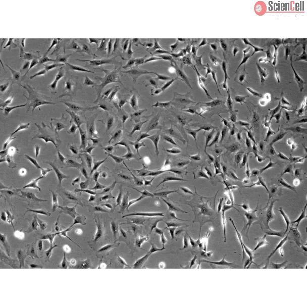 Rat Cardiac Fibroblasts (RCF) - Phase contrast, 100x.