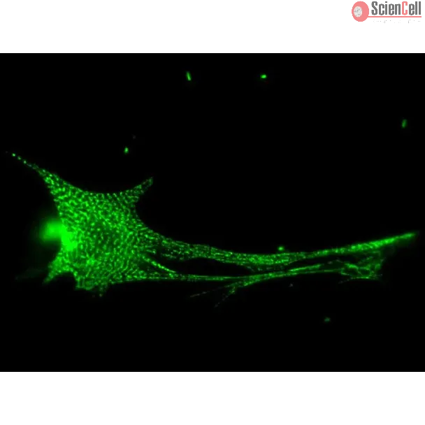 Rat Cardiac Myocytes (RCM) – Immunostaining for Sarcomeric alpha-Actinin (Boster, Cat #MA1104)
