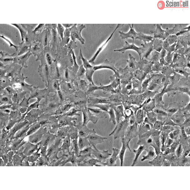 Rat Lens Epithelial Cells (RLEpiC) - Phase contrast, 200x.
