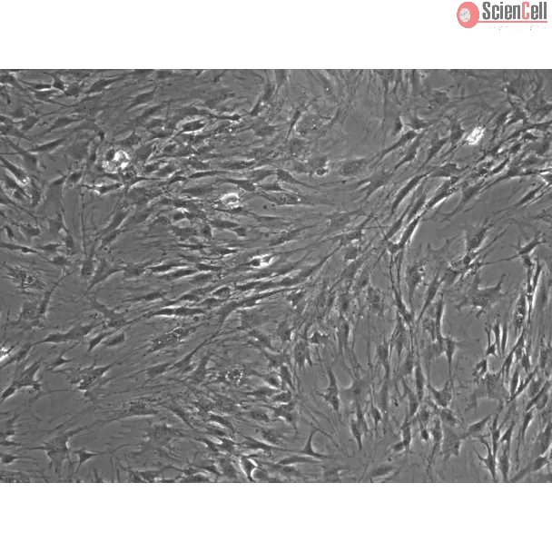 Rat Lymphatic Fibroblasts Phase Contrast