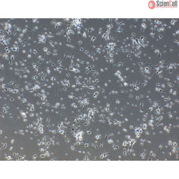 Rat Neurons-forebrain (RN-fb)-Phase Contrast, 100X