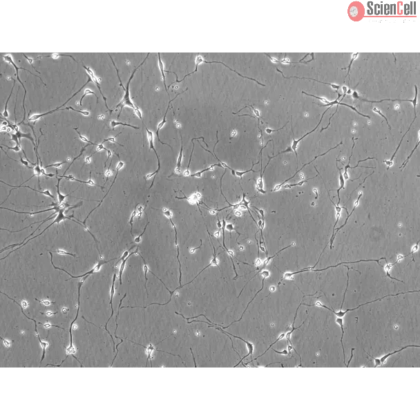 Rat Neurons-hippocampal (RN-h) - Phase contrast, 200x.

