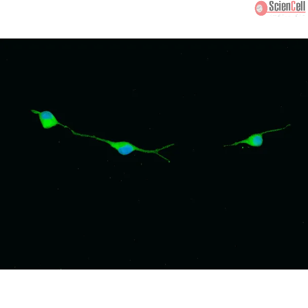 Rat Oligodendrocyte Precursor Cells (ROPC) – Immunostaining for O1, 400x.
