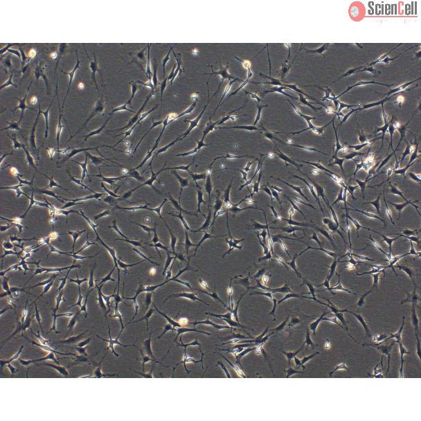 Rat Perineurial Fibroblasts (RPNF)- Phase Contrast, 100X.