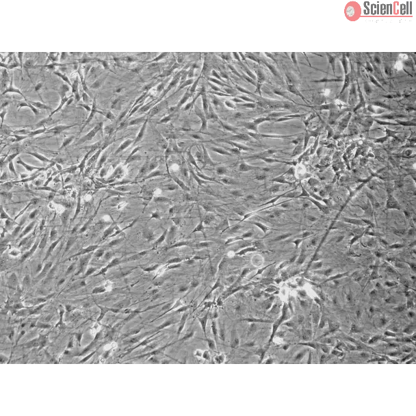 Rat Pituitary Cells (RPC) - Phase contrast, 100x.
