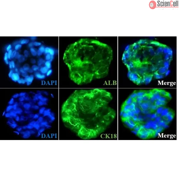 Day 7; Immunostaining of the hepatocyte-stellate cell co-culture spheroids with the hepatocyte markers such as albumin (ALB) and cytokeratin18 (CK18)
