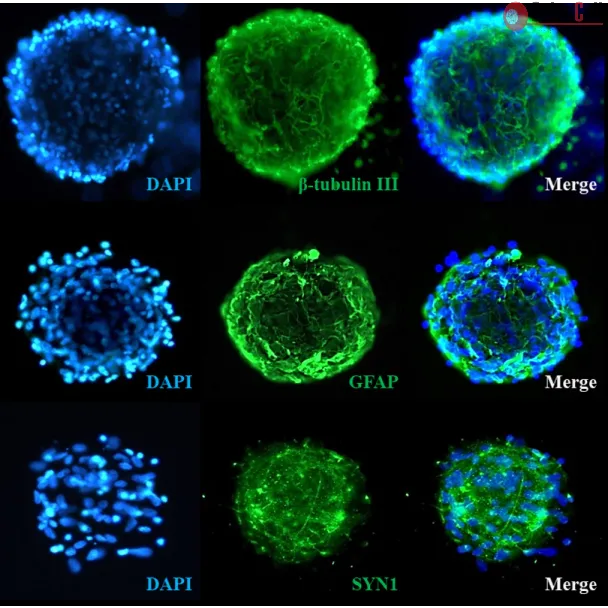 Human Cortical Spheroids at Day 7