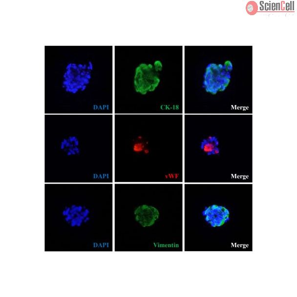 Human mini liver spheroids express hepatocyte marker cytokeratin 18 (CK-18), stellate cell marker vimentin and sinusoidal endothelial cell marker von Willebrand factor (vWF). 