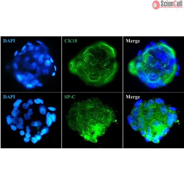 Immunostaining of the human pulmonary alveolar epithelial cell spheroids with the epithelial cell marker CK18 and the specific alveolar epithelial cell type II marker SP-C. 