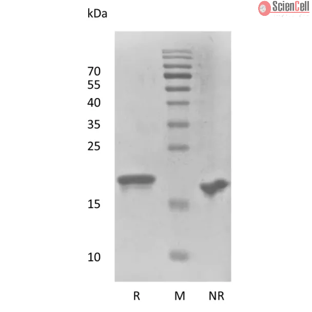 Recombinant Human Fibroblast Growth Factor-21 Thermostable