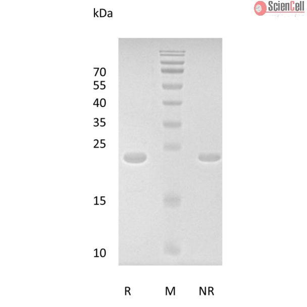 Recombinant Human Fibroblast Growth Factor 8