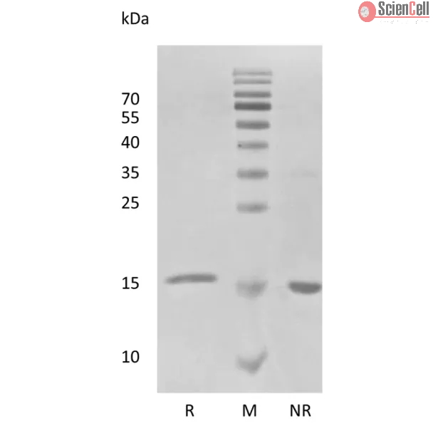 Recombinant Human Interferon-alpha2a