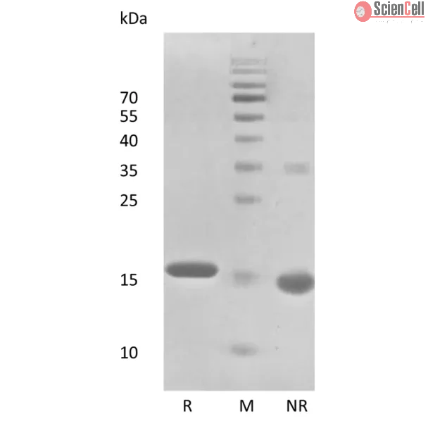 Recombinant Human Interferon-alpha2b 