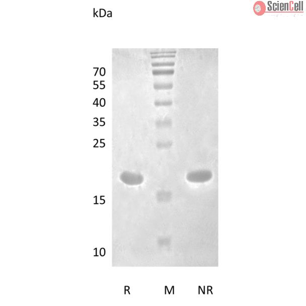 Recombinant Human Interleukin-1 beta