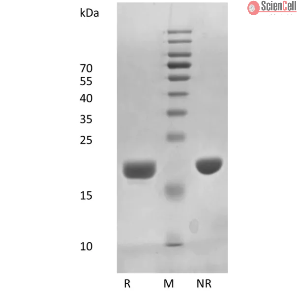 Recombinant Human Interleukin-11