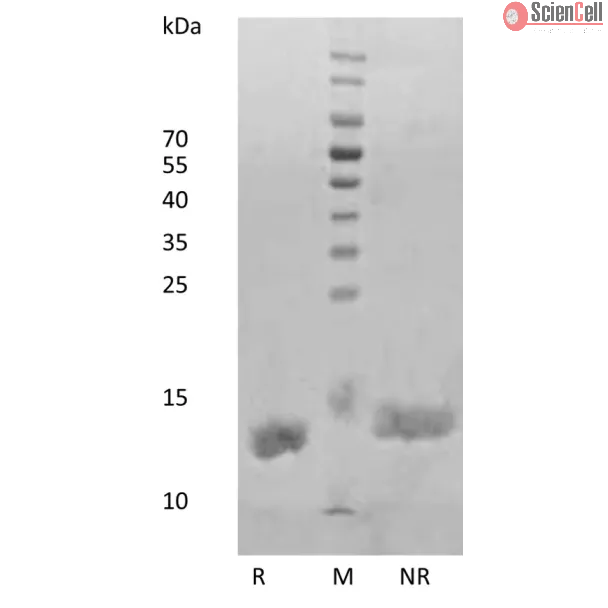 Recombinant Human Interleukin-2