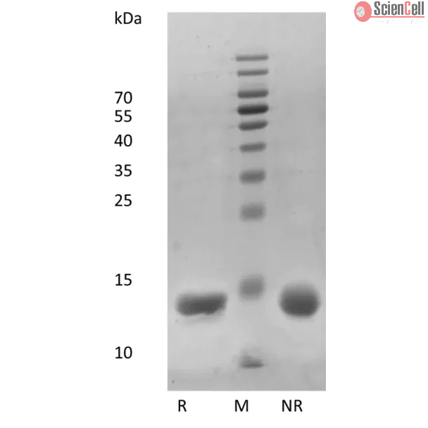 Recombinant Human Interleukin-3