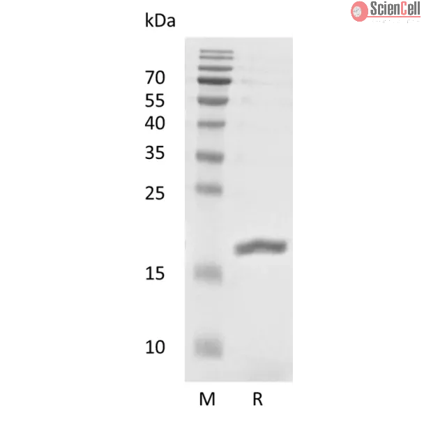 Recombinant Human Leukemia Inhibitory Factor