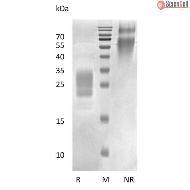 Recombinant Human Placental Growth Hormone