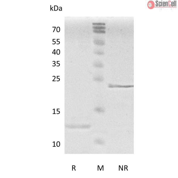 Recombinant Human Transforming Growth Factor-β2