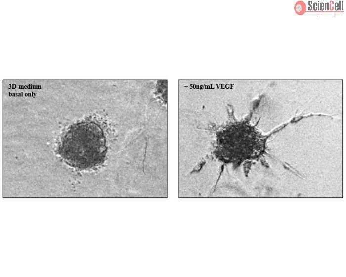 Collagen-embedded HUVEC spheroids at 24 hours post VEGF-stimulation