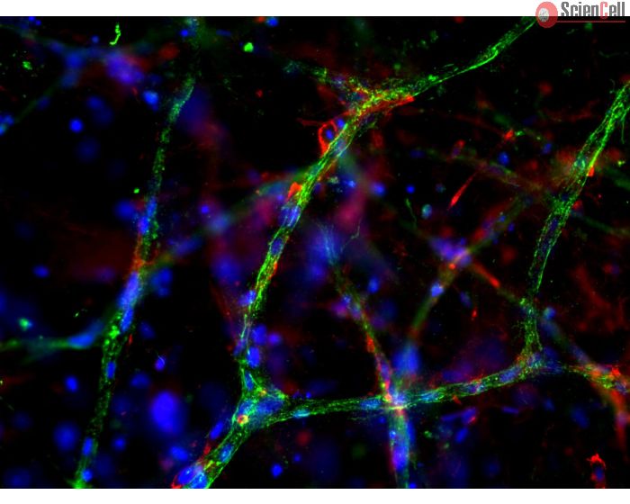 Day 9 post-embedding: Endothelial cells stained with VWF (green) and pericytes stained with NG2 (red)