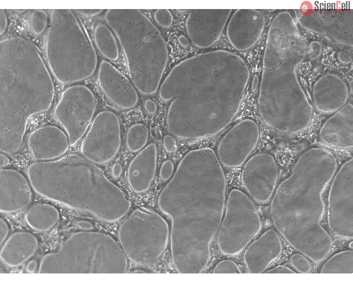 Cells day 4 of assay, 100x (day 4 cond1-10x)
