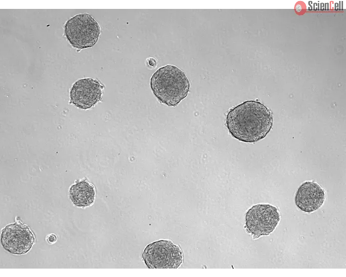 Development of 3D osteoblast spheroid at days 3 (taken at 100x magnification). 