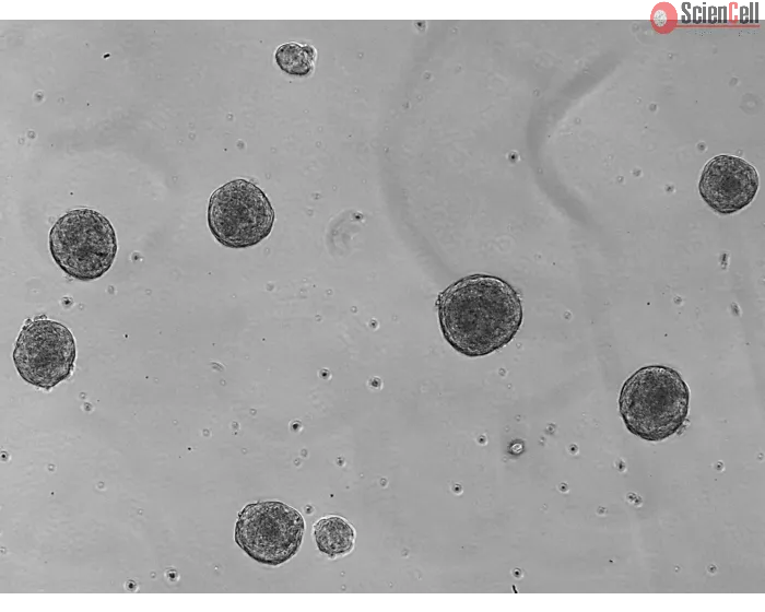 Day 5: Osteoblast and endothelial cells co-culture spheroids