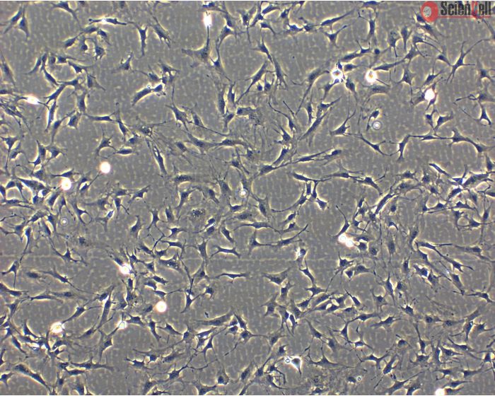 Phase Contrast Caption:     Bovine Astrocytes (BA)- Phase Contrast