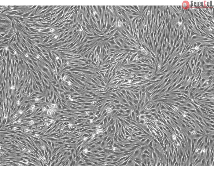 Bovine Brain Microvascular Endothelial Cells (BBMEC) - Phase contrast