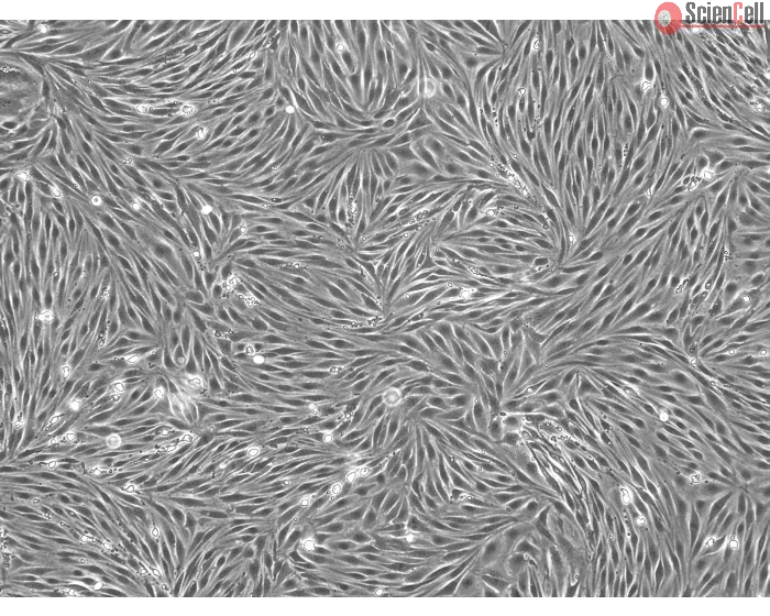 Bovine Brain Microvascular Endothelial Cells (BBMEC) - Phase contrast, 100x
