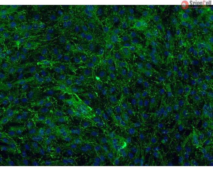 Bovine Meningeal Cells (BMC)-Immunostaining for FN, 200X