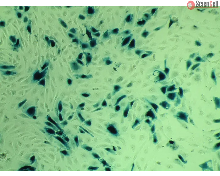 Transfections-EndoF