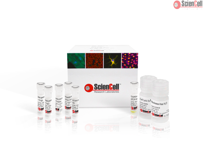 GeneQuery™ Human Biological Sex Determination qPCR Assay Kit (HSDQ)