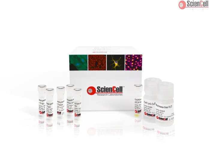 GeneQuery™ Human Biological Sex Determination qPCR Assay Kit (HSDQ)