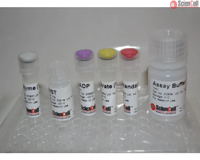 Glucose 6 Phosphate Assay G6p