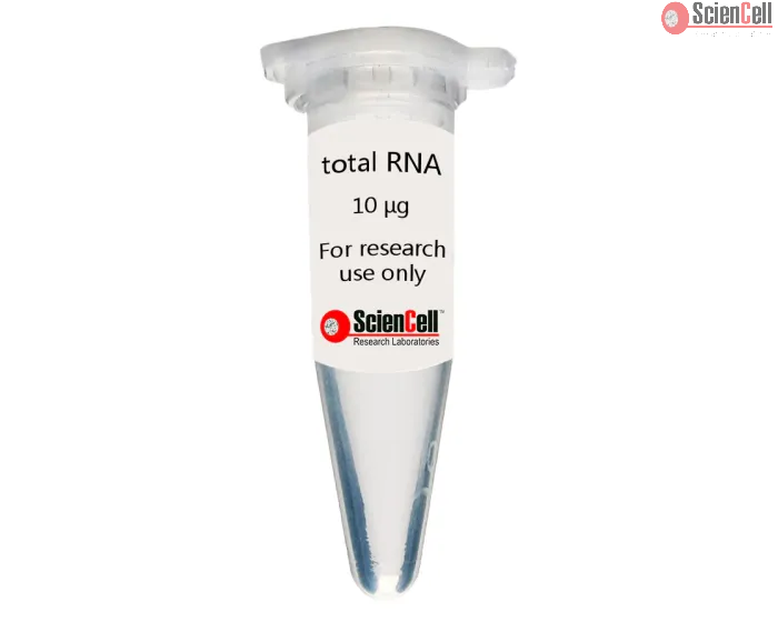 HDF-derived Human Induced Pluripotent Stem Cell Total RNA