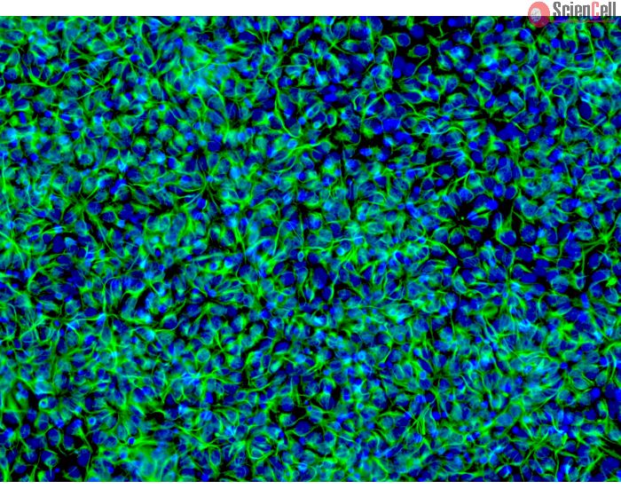 hiPSC derived neural stem cell - Immunostaining for Nestin (green)