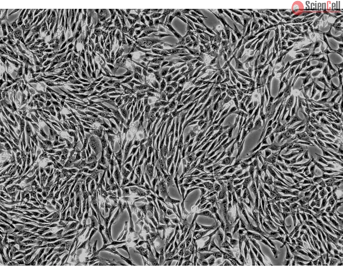 Horse Mesenchymal Stem Cells-adipose (HNSC-ad) - Phase Contrast 100X