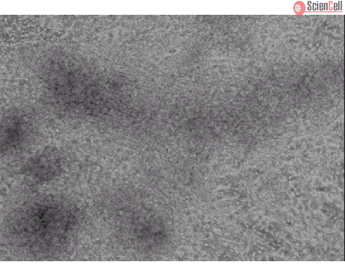 HPSC-derived Cardiomyocyte Cells