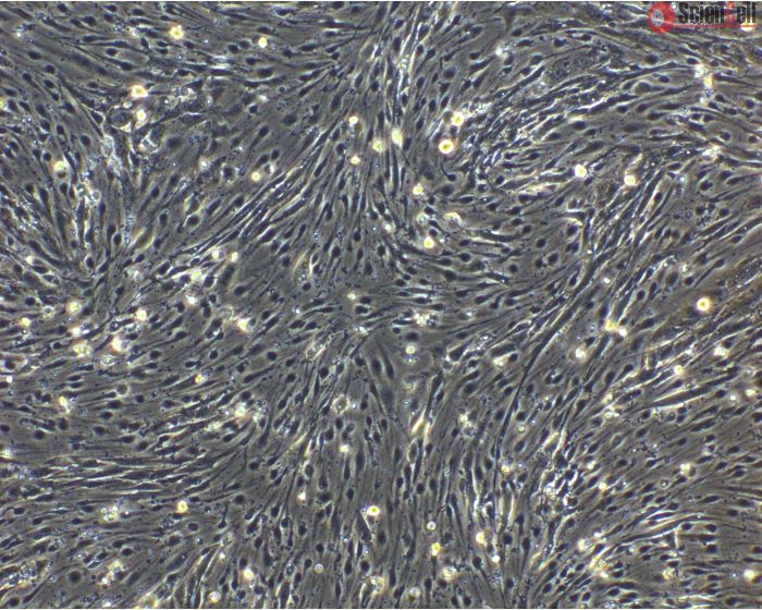 hPSC-Derived Endothelial Cells (hPSC-EC) - Phase contrast, 100x